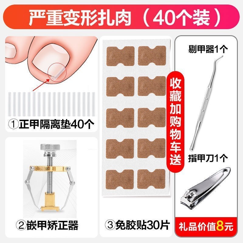 厂家甲沟垫甲沟嵌甲炎填充垫片矫正器贴正甲贴指甲脚趾甲长肉里|undefined
