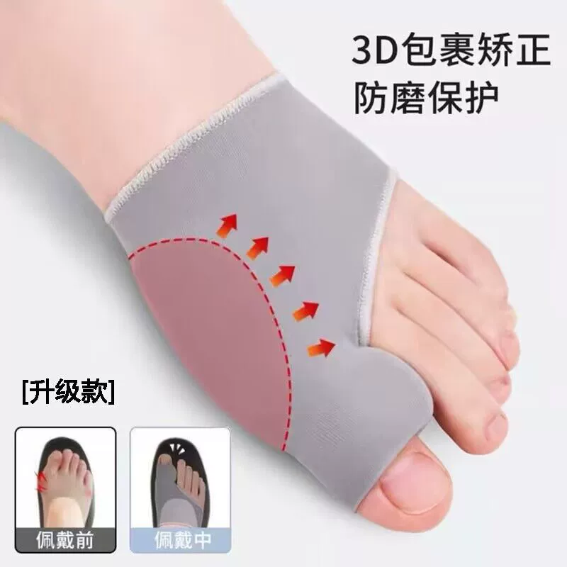 Модернизированная версия защитных чехлов для ног SEBS, корректор вальгусной деформации, женские дневные и ночные большие чехлы для пальцев, мужские чехлы для ног с разделителем пальцев