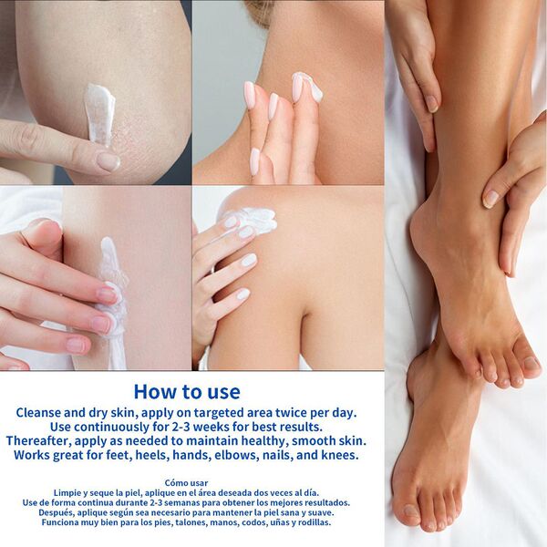 urea cream for skin care