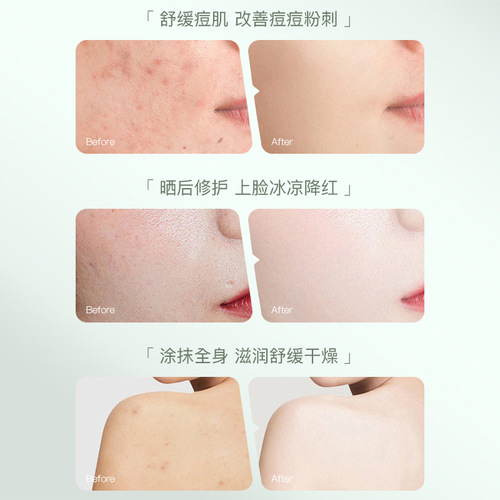 Shijing aloe vera gel hydrating moisturizing gel exfoliating cream after sun repair skin oil control refreshing