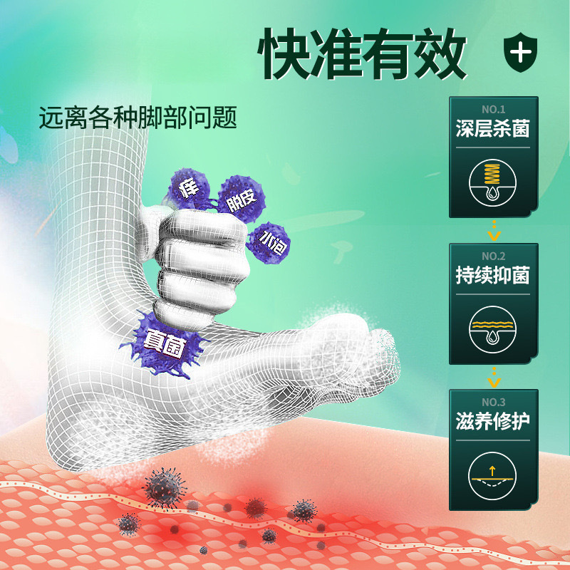 ビフォナゾールスプレー、ピナゾール、皮膚用ビフォナゾール、足のかゆみ、足の臭いピーリング、水虫クリーム、かゆみ止め抗菌液|undefined