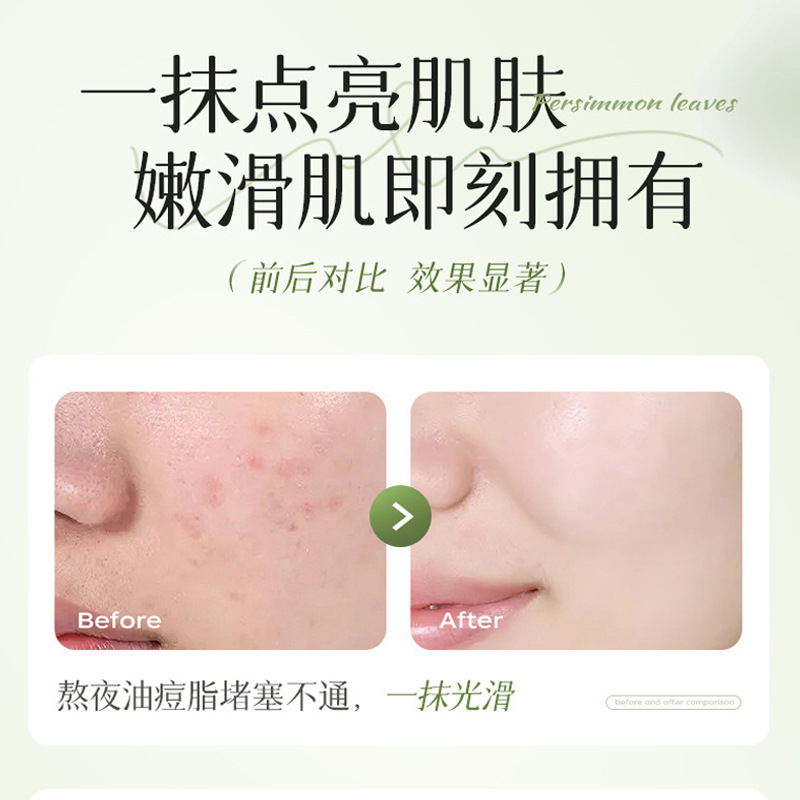 La esencia de Lanyanzhi mejora la piel áspera, rehidrata, brilla, suave, suave, hidrata, suave, crema de salsa de hoja de notoginseng.