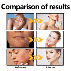 Hoygi 保濕防護霜 夏季防禦紫外線防護輕盈不油膩透氣清爽護理霜