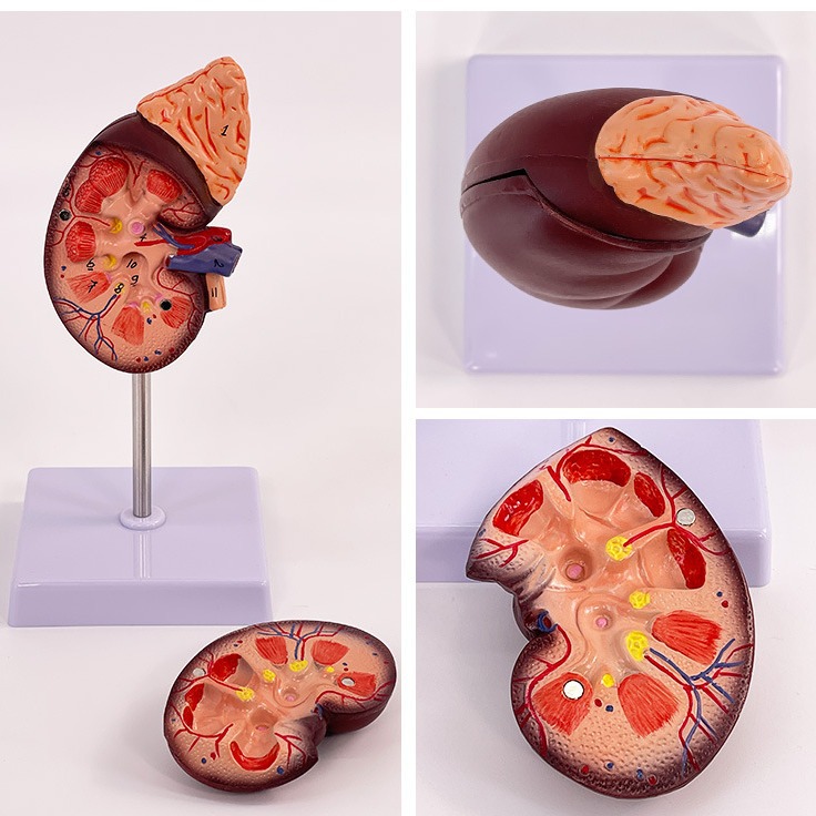 Enseñanza modelo de simulación de riñón humano espécimen 1:1 Natural gran modelo de riñón humano anatomía visceral