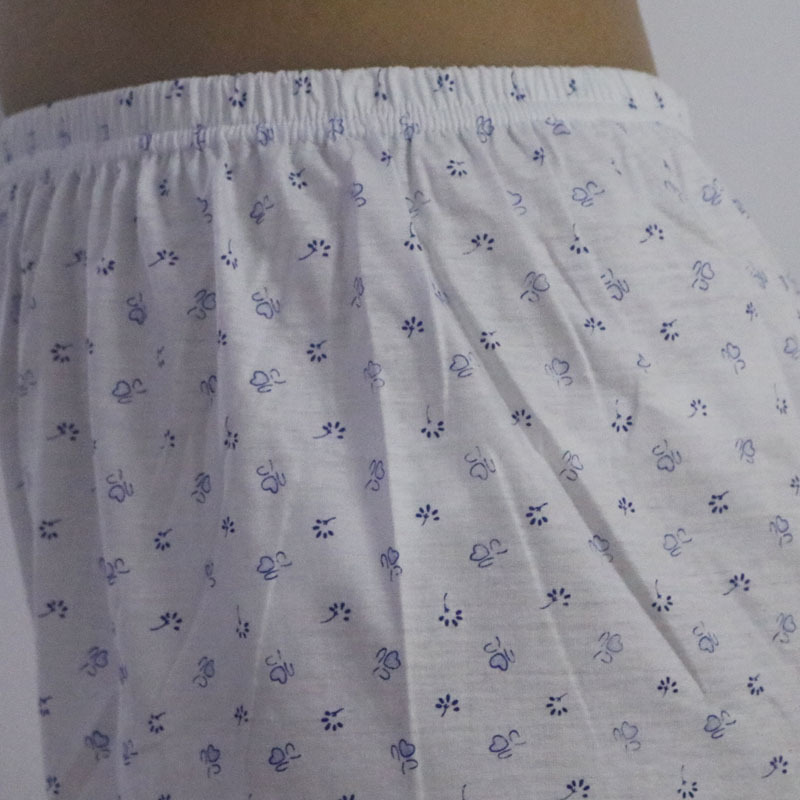 20170303210257_IMG_1405