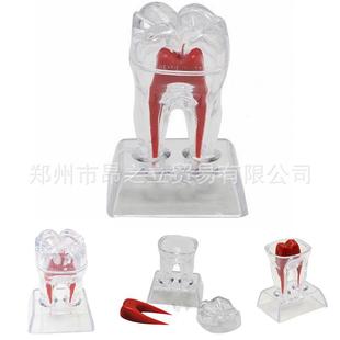 Dental Material Dental Model Single Large Tooth Decomposable Tooth Model Dental Mold Transparent Tooth Decomposition Model