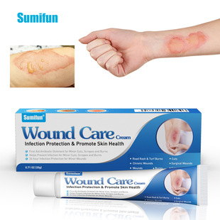 sumifun cross-border Amazon Tiktok burn care ointment to relieve skin fever burns K10207