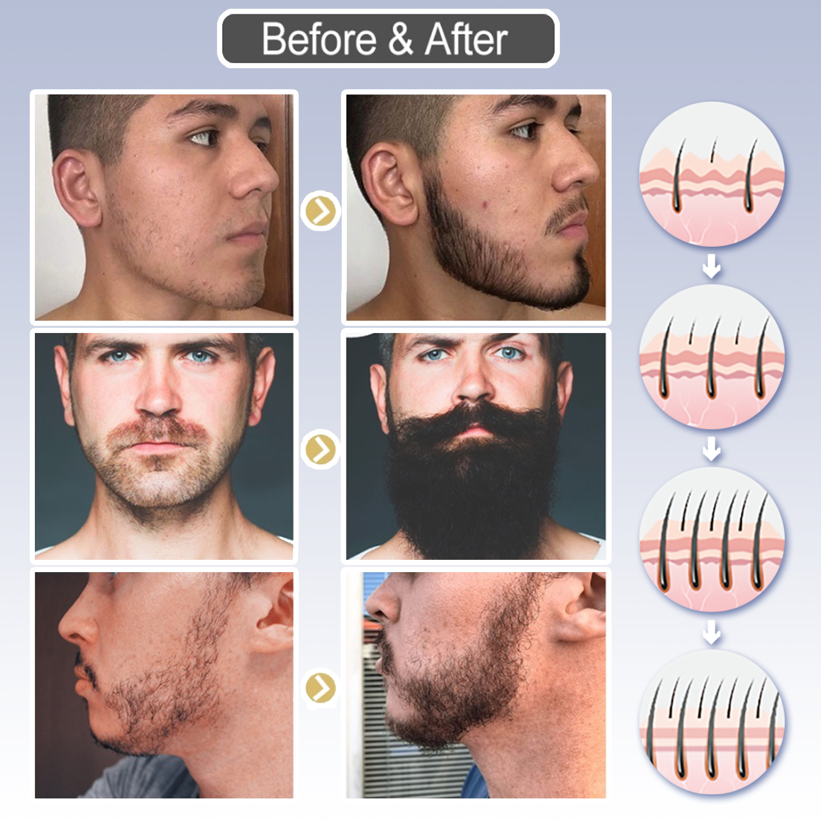 Sérum de croissance de barbe riche en ingrédients naturels pour hommes | Favorise une croissance de barbe plus épaisse et plus complète_voghion.com