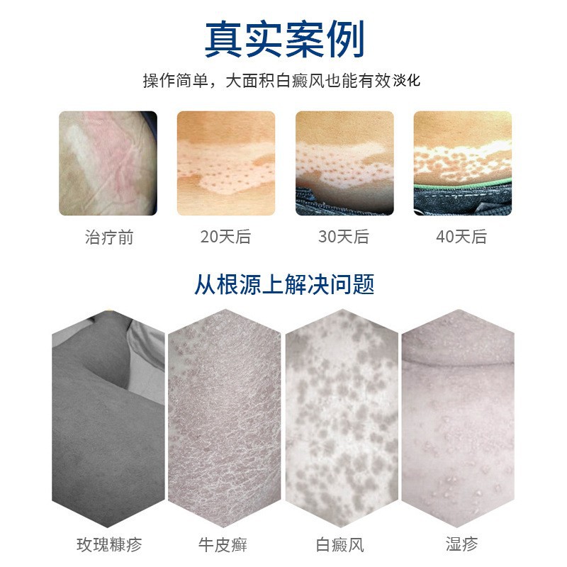 O1CN01aCrrNd1OW8uNB7OSH_!!2215