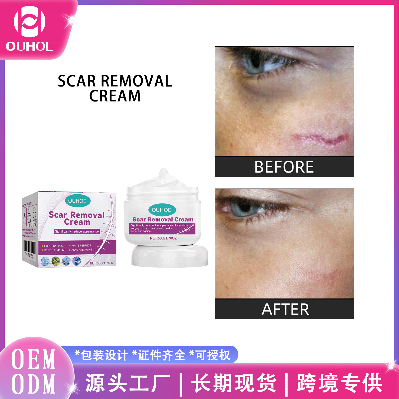 Ouhoe Skin Care Cream Gentle Nourishing and Moisturizing Body Skin Daily Care Facial and Body Care Cream