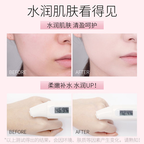 Laiko lily plant extract radiant moisturizing lotion 125ml hydrating moisturizing essence water emulsion skin care products