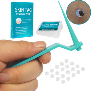 skin Tag rubber Band Remover meat nevus meat skin Tag removal meat nevus set wart
