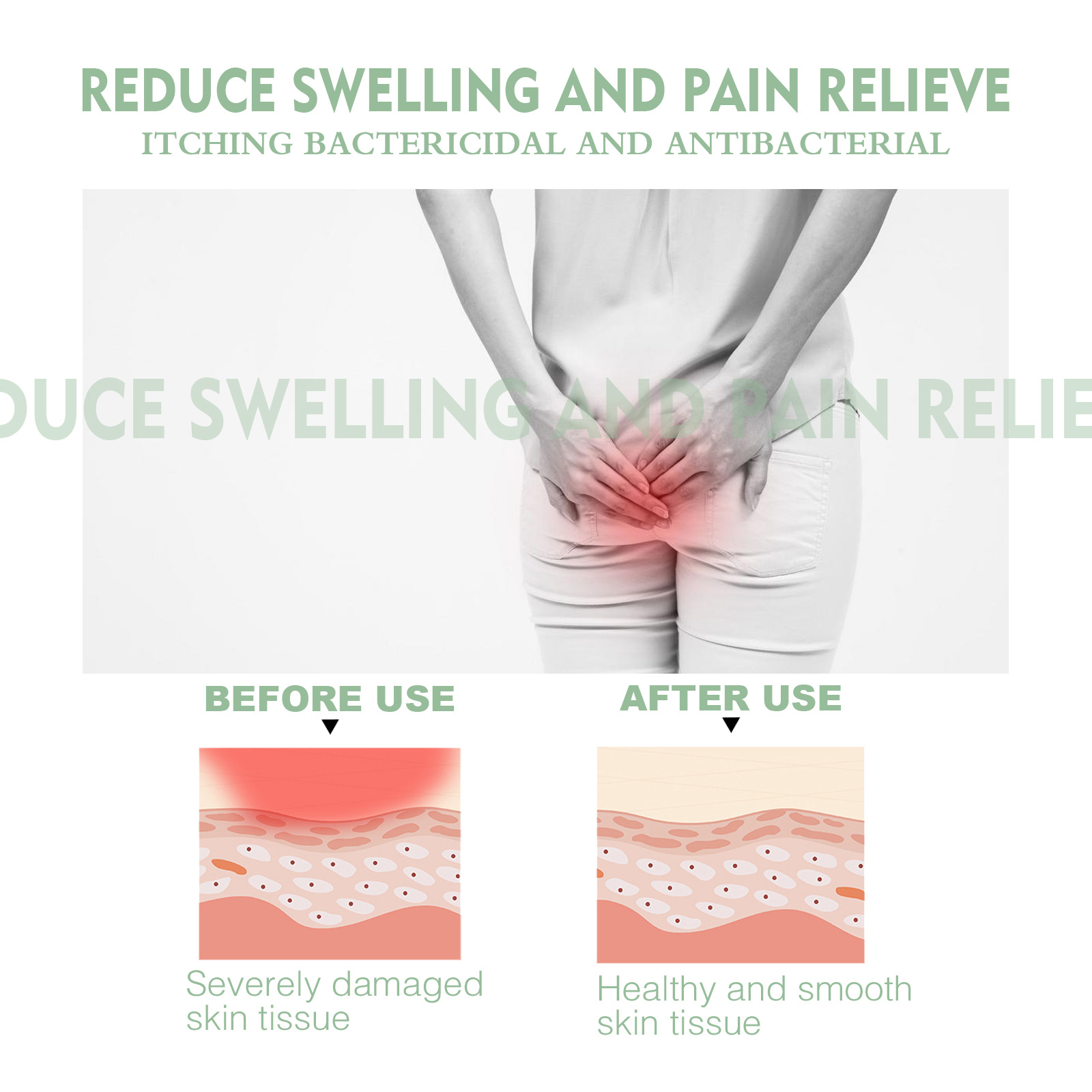 Hemorrhoids Relief Cream Image 5