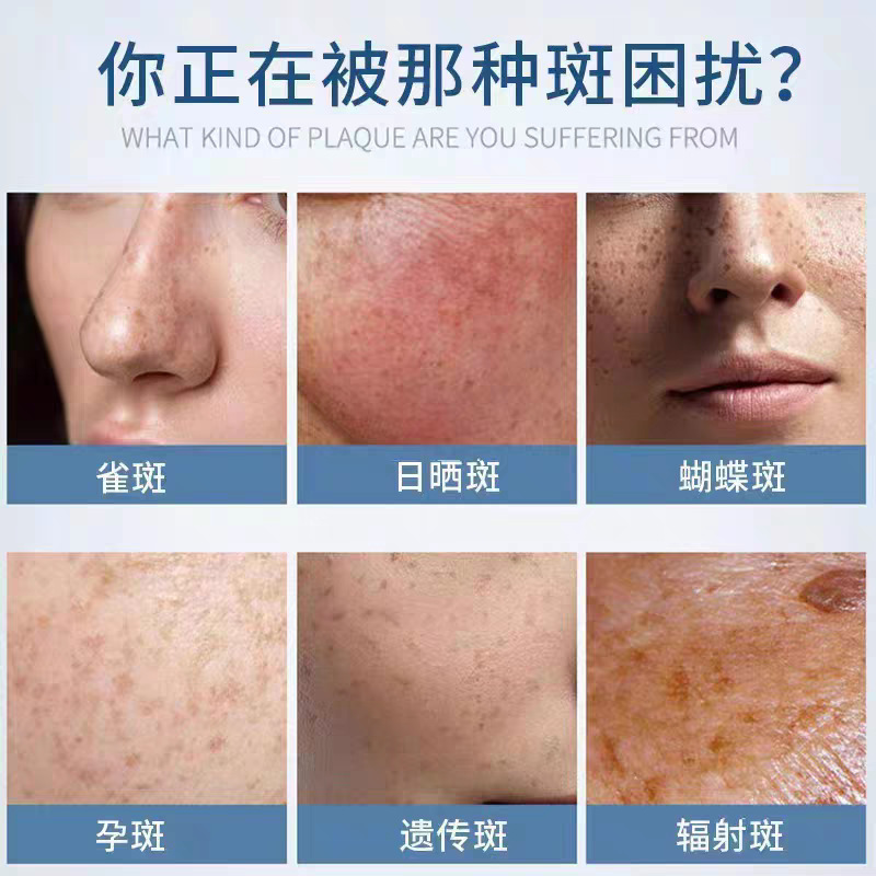 祛斑排色液院线专供黄褐斑色素分解美白净肤精华液点斑专用药水|undefined