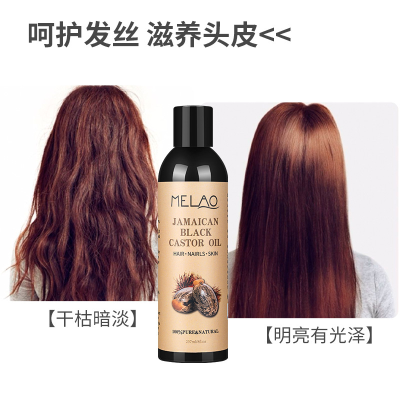 クロスボーダージャマイカブラックヒマシ油ヘア頭皮ケアマッサージヘアケアエッセンシャルオイルブラックヒマシ油|undefined