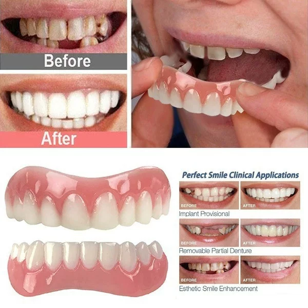 Кросс-брендовая электронная торговля Instant Smile отбеливание силиконовые брекеты моются и повторно используются имитированные зубы