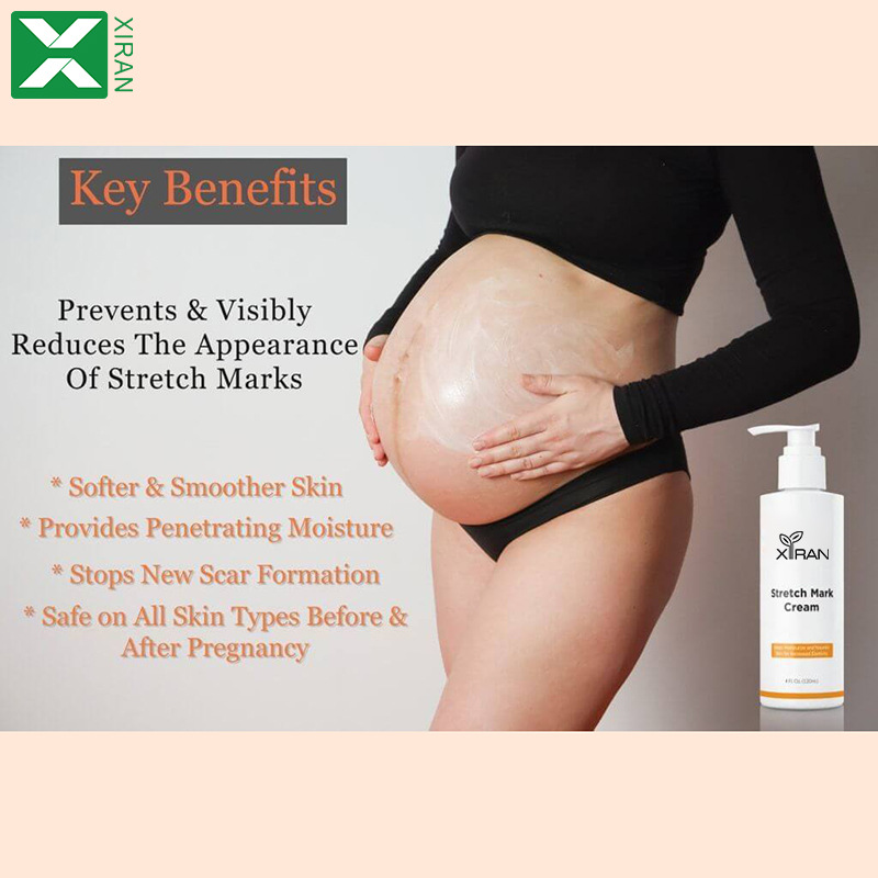 Cross-Border Exclusive Supply of Customized Body Lotion for Pregnant Women to Remove Stretch Marks on the Belly. Stretch Marks Removal Cream