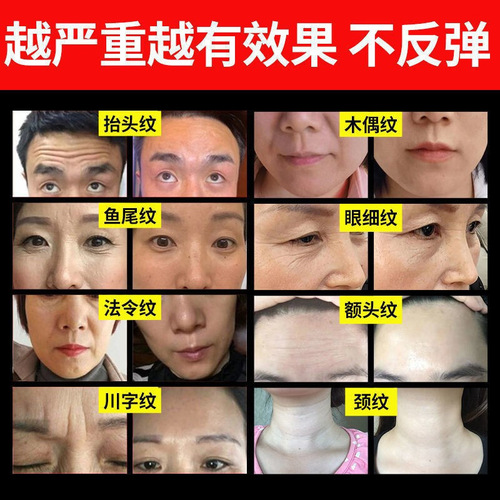 Rich in 7 types of collagen restructuring cream, anti-wrinkle, firming, repair, moisturizing and rejuvenating collagen cream beauty salon