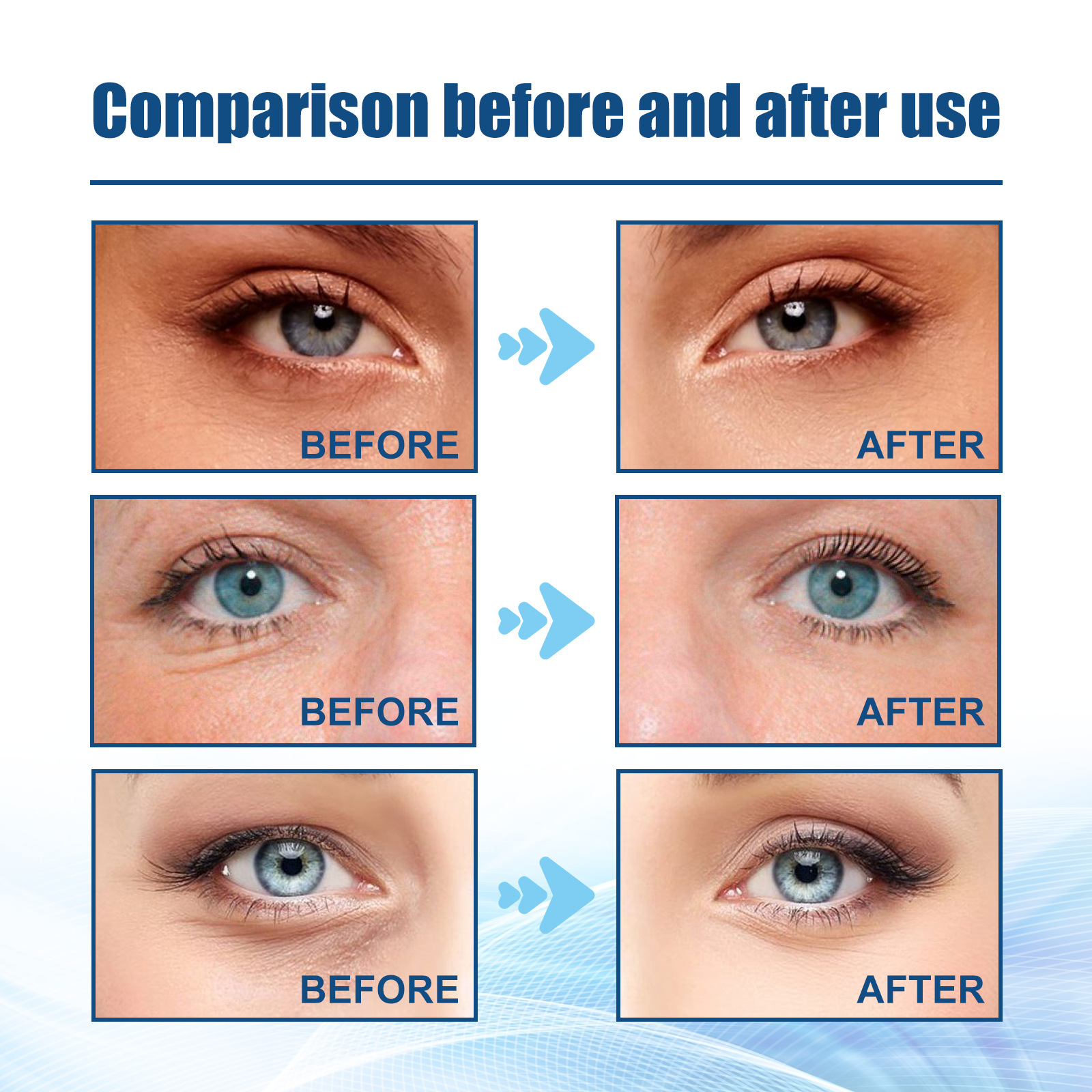 Shock Jaysuing Micro Repair Hydratant, Raffermissant, Anti Rides, Estompage des Ridules, Cernes, Nourrissant_voghion.com