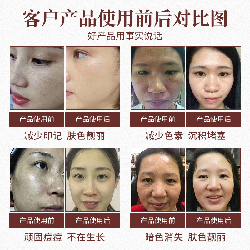 草本のマスクの粉の美容院の専用の草本は痘の7子の白い純の草本のマスクの粉を取り除いて黄色の柔らかいマスクの粉を取り除きます。|undefined