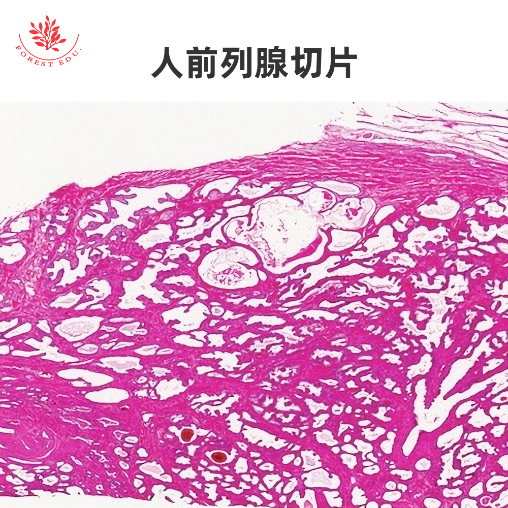 6-人前列腺切片