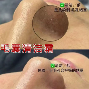 Pore Cleansing Cream, Beauty Salon Special Deep Cleansing and Purifying Cream for Hair Follicles, Exfoliating Layer Massage Cream for Facial Use in Salons
