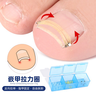 Toe inlaid nail ring stretch rebound nail groove nail roll physical reverse stretch walkable washable reusable