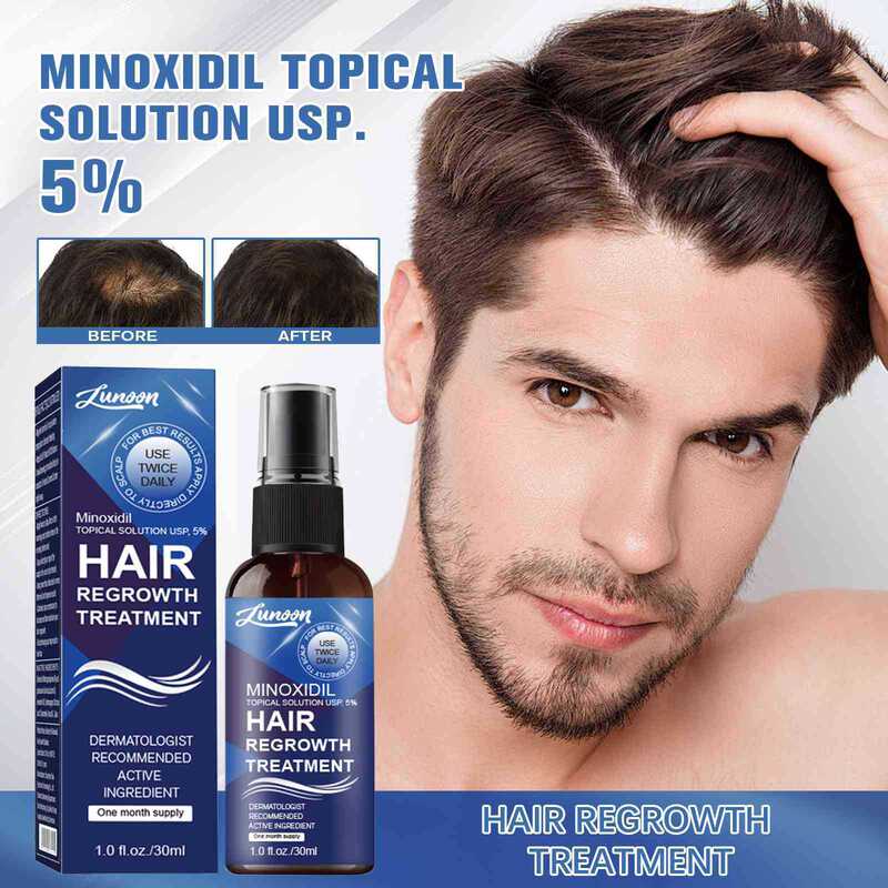 クロスボーダー LUNOON ミノ/ディル スプレー ヘアエッセンス 抜け毛防止栄養液 30ml|undefined