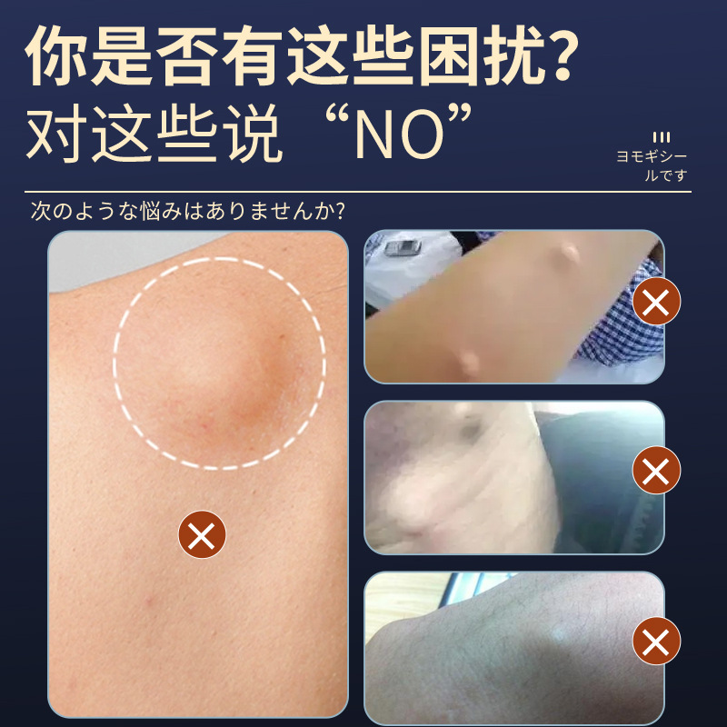 明野製藥脂肪貼皮下脂肪硬塊纖維節貼脂肪L貼瘤