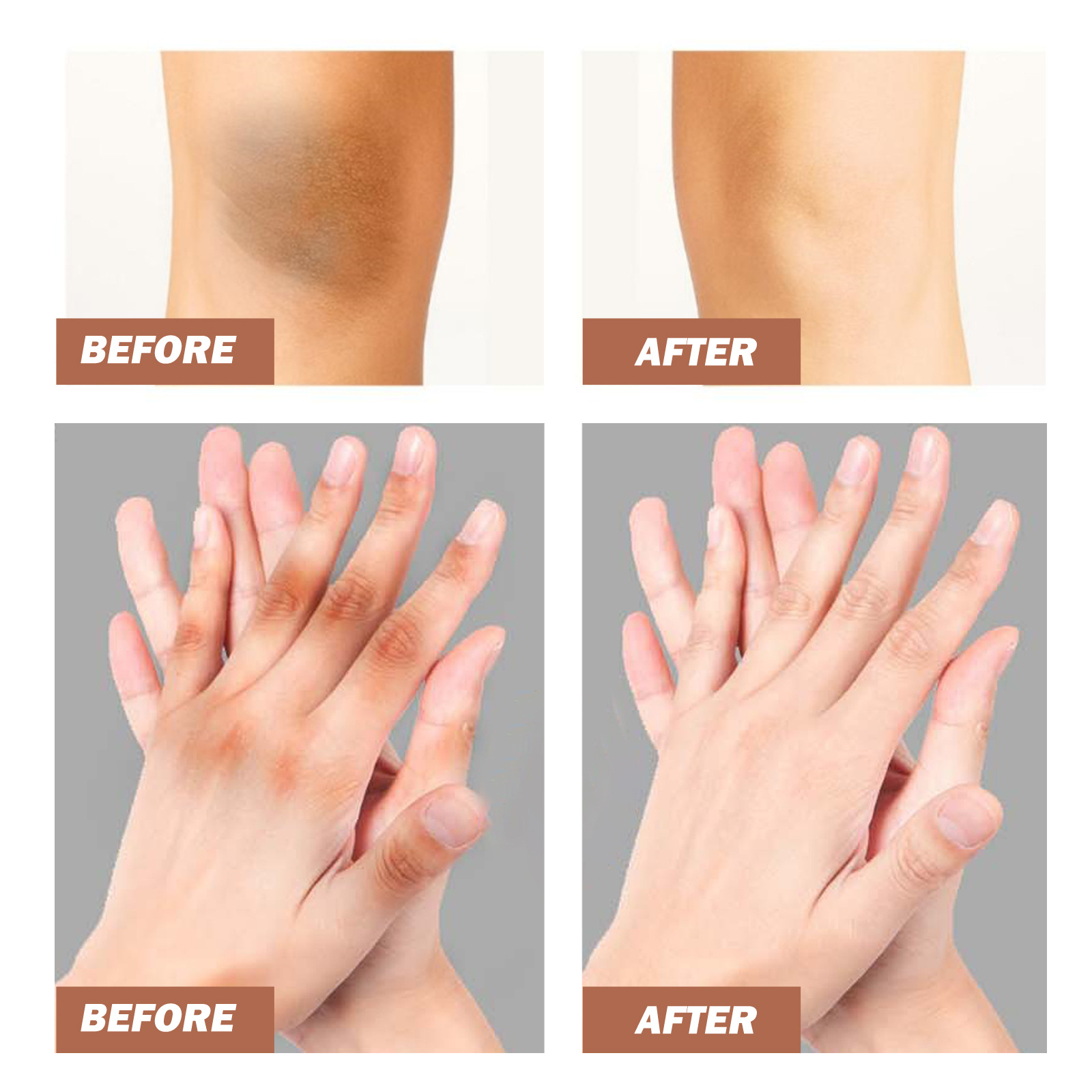 EELHOE crema schiarente e schiarente per articolazioni, collo, gomiti e ginocchia crema schiarente esfoliante e sbiancante alla melanina_voghion.com