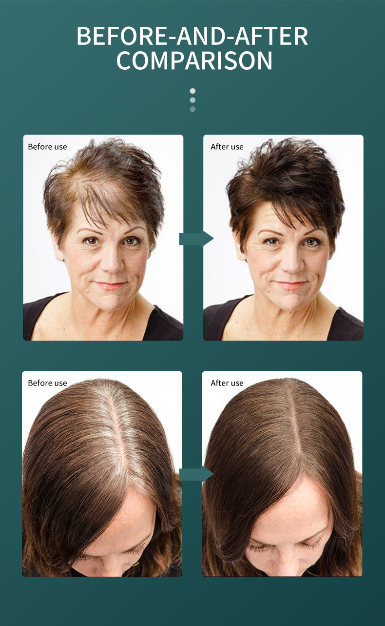 HAIR GROWTH SERUM soluzione per la cura dei capelli_voghion.com