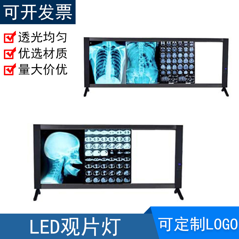 医院用LED观片灯阅片灯箱双联骨科阅片牙科看片灯x光三联观灯片