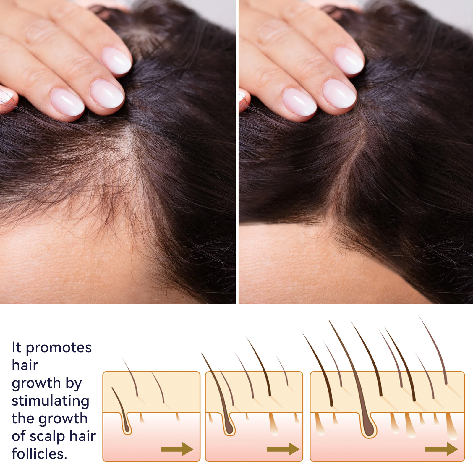 OUHOE Hair Mist