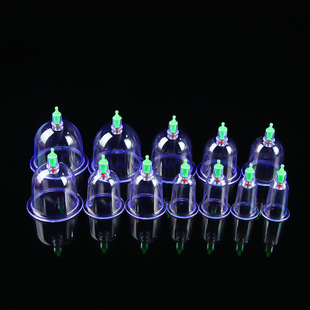 Cupping͸��һ������հι�������йѪ�޼��Æι�ɢ�޳��ްλ�