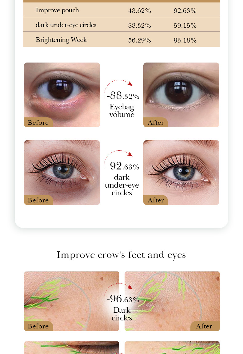 Maschera occhi in cristallo sadoer rassodante nutriente idratante_voghion.com