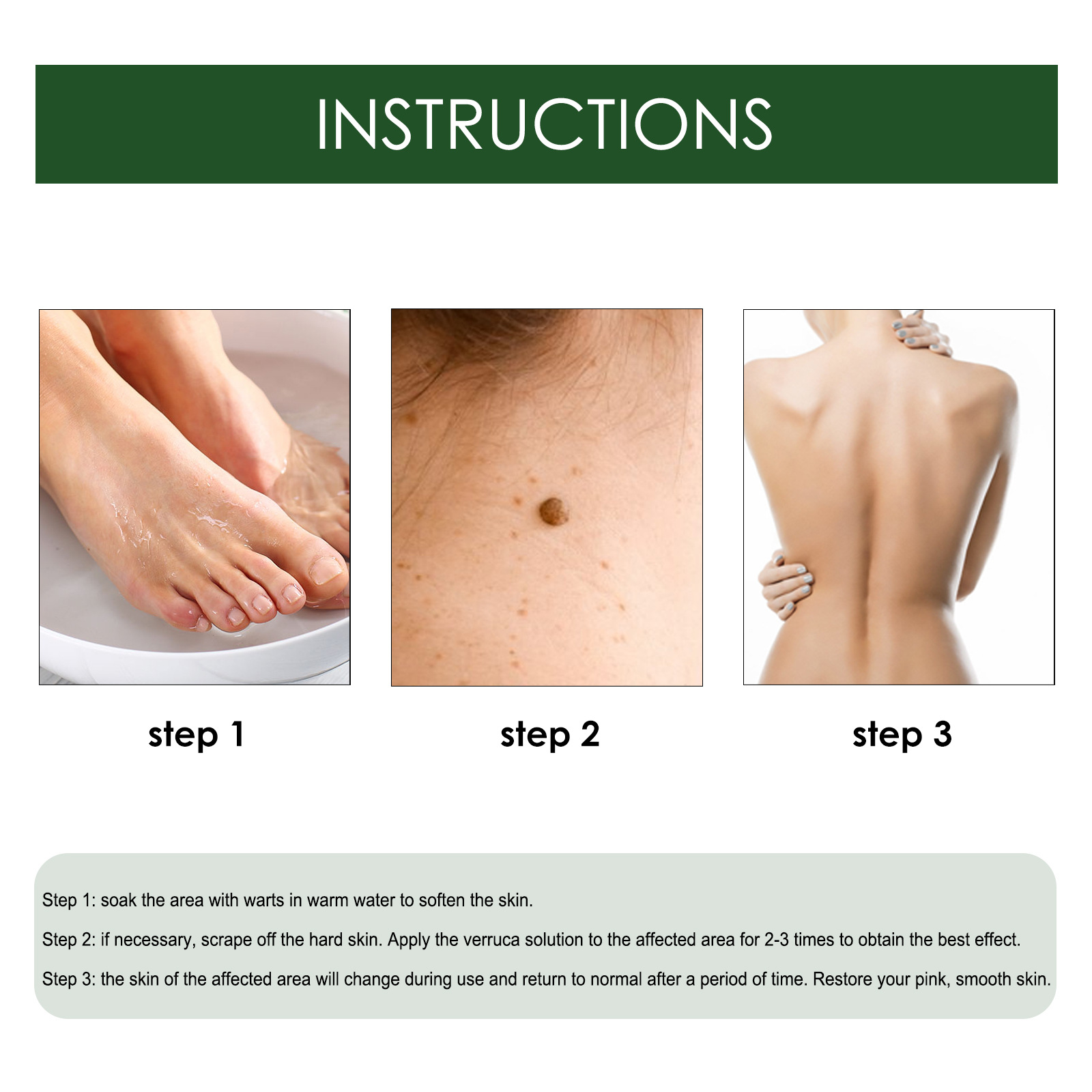 2024 wart remover to lighten flesh thorns, flat skin, especially corns, body warts, and filamentous warts_voghion.com