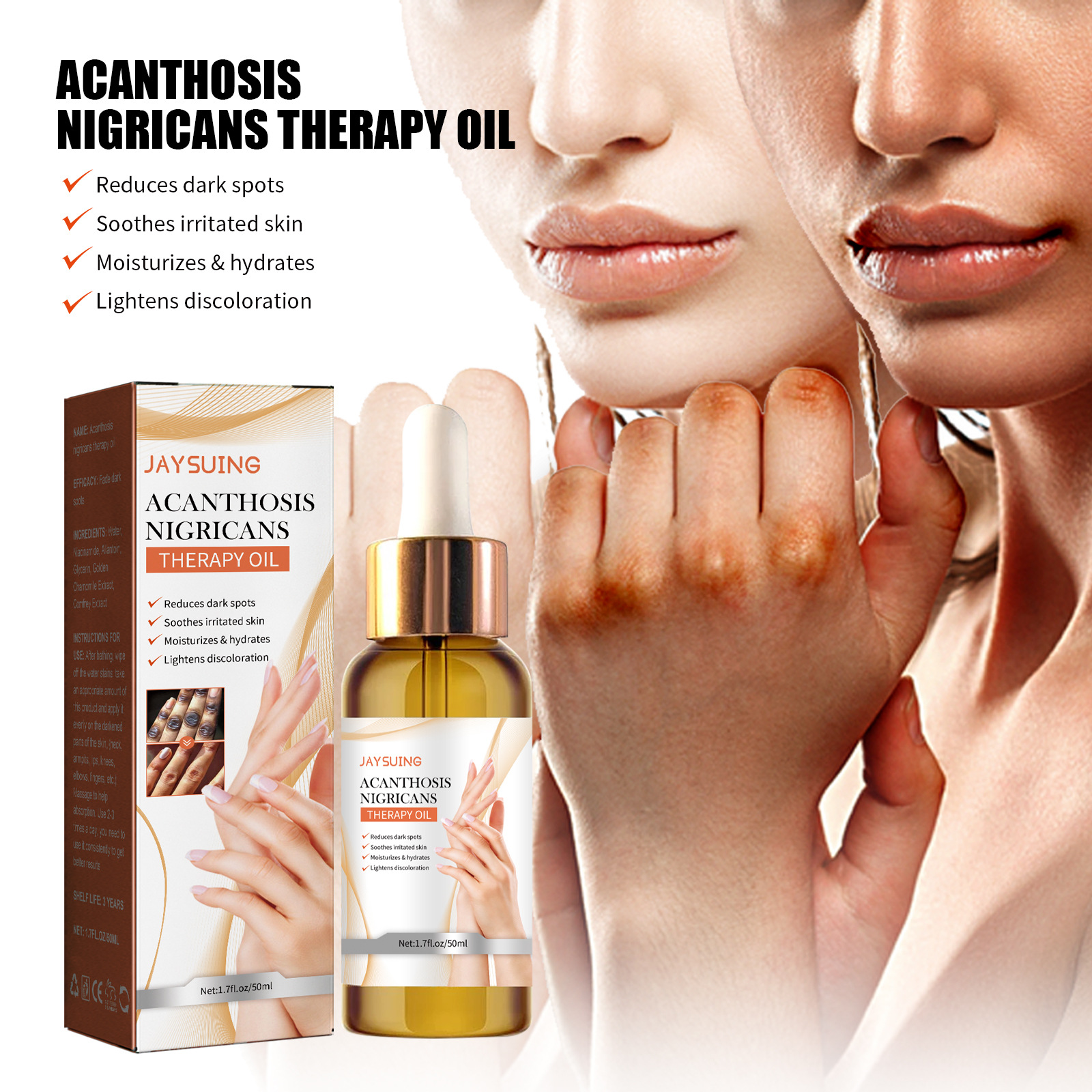 Óleo de terapia acanthosis nigricans para reparar e clarear_voghion.com