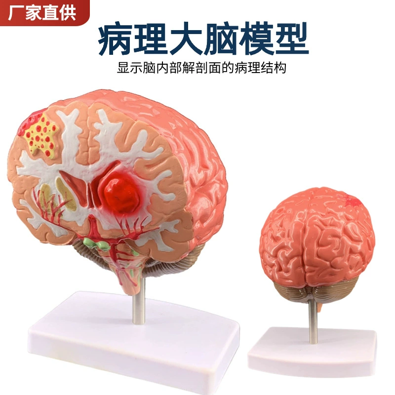 Brain model Brain function area color division model Human brain anatomy human cerebral artery structure cerebrovascular nerve