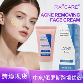 跨境全英文批发淡痘面霜淡化痘清爽控油保湿淡痘膏欧美tiktok批发