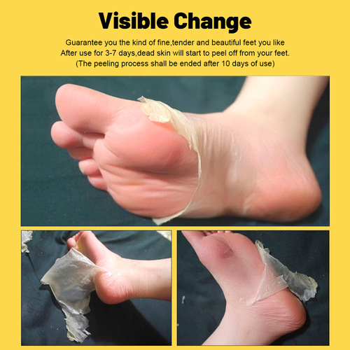 AICHUN Cross-border Banana Peeling Foot Mask Hydrating Brightening Exfoliating Foot Care Wholesale Foot Patch