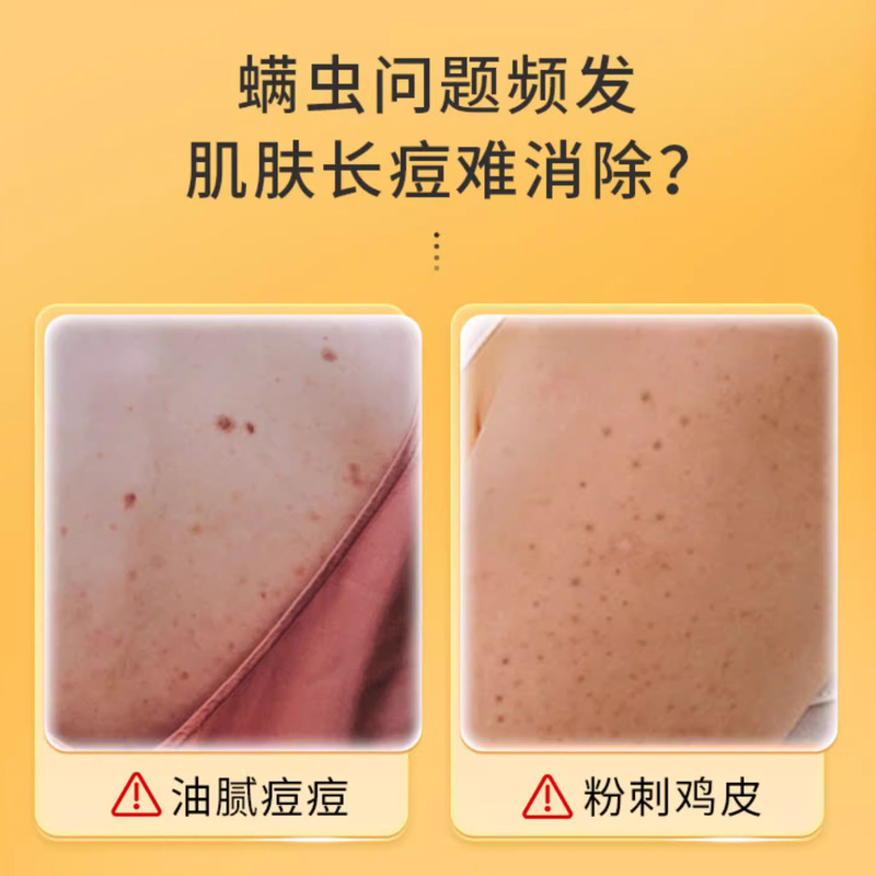 南京銅仁堂硫黄ダニ除去液体石鹸青椒ダニを除去し、肌を優しく若返らせ、かゆみを和らげます、卸売および配送用に在庫あり|undefined