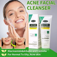 Трансграничная внешняя торговля ACNE FACIAL CLEANSER Очиститель для лица Уход за лицом Очищающий молочный завод оптом