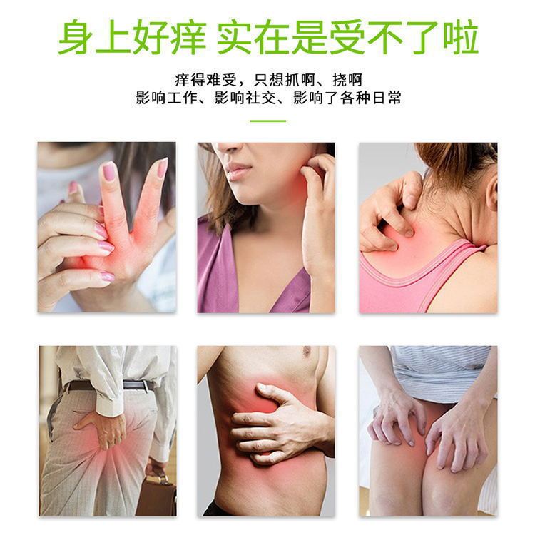 コケ軟膏殺菌皮膚かゆみ止め菌全身かゆみ外用百草かゆみ止めクリーム牛革コケ新鮮膏|undefined