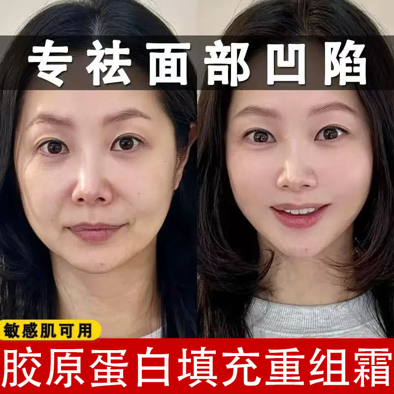 Collagen Filling Cream, Anti-Wrinkle Firming Cream, Fades Fine Lines, Lifts, Tightens, Moisturizes, Anti-Wrinkle Cream, Restructuring Cream Collagen Filling Cream, Anti-Wrinkle Firming Cream, Fades Fine Lines, Lifts, Tightens, Moisturizes, Anti-Wrinkle Cream, Restructuring Cream