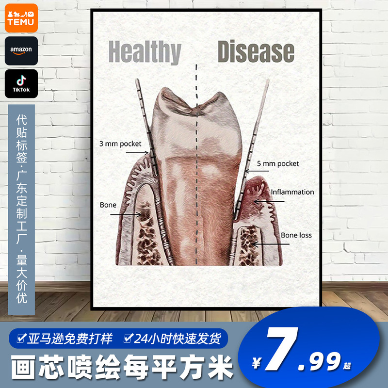 Temu Gum Health and Disease Art Decorative Painting Spray-Painted Canvas Artwork Bedroom Living Room Decorative Canvas Painting Temu Gum Health and Disease Art Decorative Painting Spray-Painted Canvas Artwork Bedroom Living Room Decorative Canvas Painting