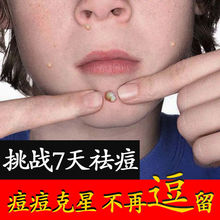 �۲��������˪���zˮ����ȥ�]�ڷ۴��ӡ���Ӷ������o�o�wƷ