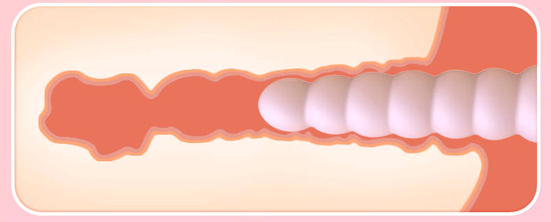 Vibrating Anal Beads with Prostate Massage, Silicone, Button Control — detail image 2