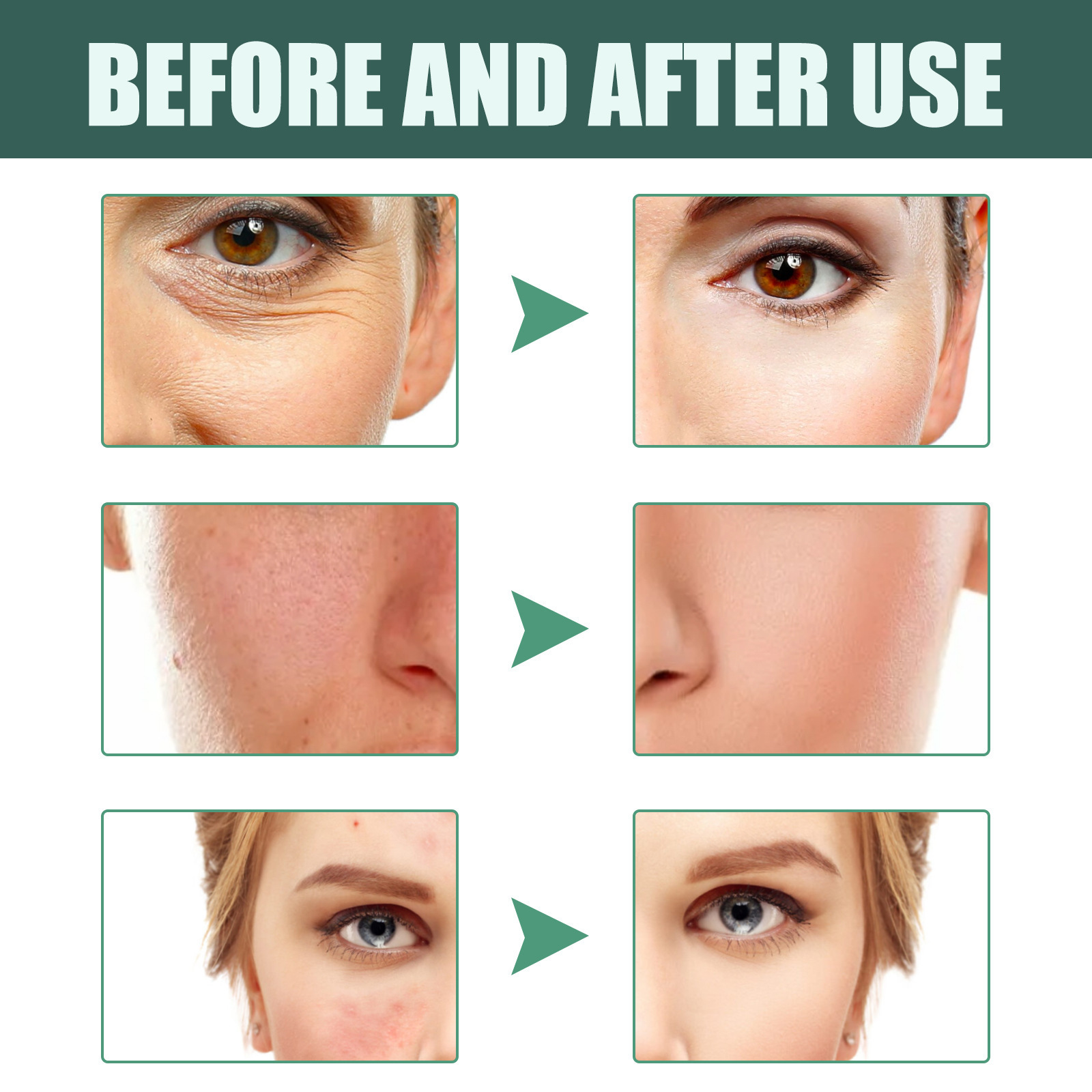 L'essenza di retinolo Jayswing riduce le linee sottili, rassoda il viso, illumina, rassoda, elasticità, tenerezza, resiste_voghion.com