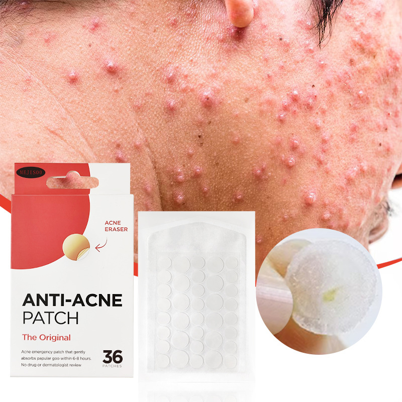 外贸跨境ANTI-ACNE PATCH痘痘贴36粒水胶体透明痘痘粉刺贴源头厂
