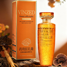 VINZED�ӿ׾��t��������y���Aˮ�������aˮ����ˮ���ˮ���y
